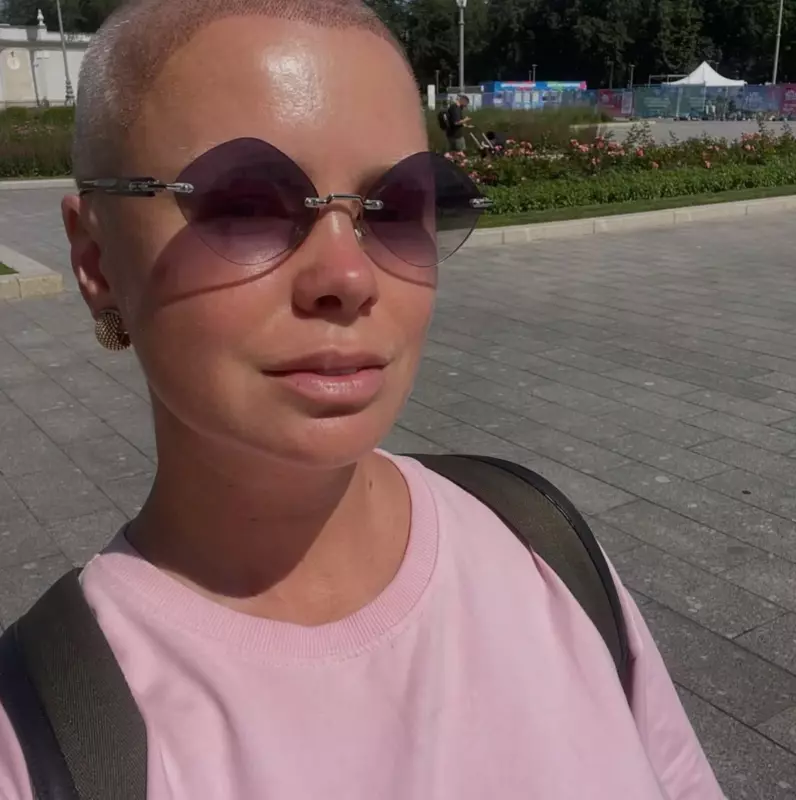 «Я сбрила всё и вернула себе молодость»: Как Евгения Осипова сбросила 15 кг, пережила предательство мужа и пересадку волос